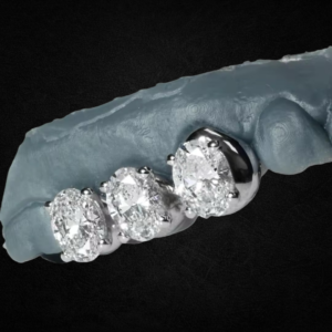 Cavère Oval Prong Set Grillz